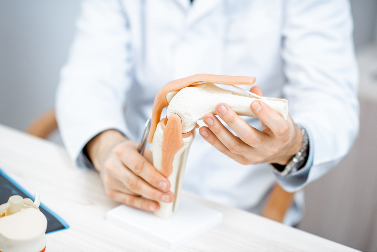 A diagram of a partial knee replacement in Kansas City