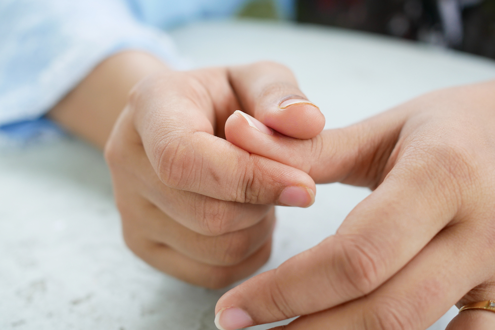 Person holding their broken finger